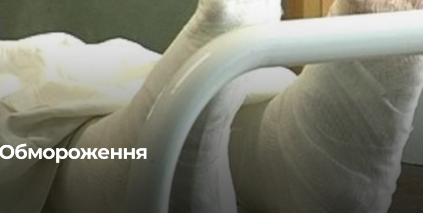Небезпека обморожень: Рятувальники закликають до обережності в холодну погоду