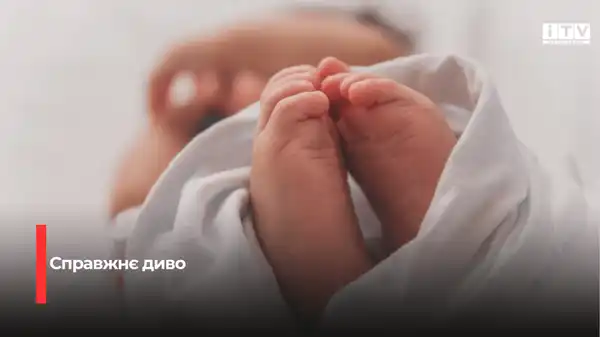 Унікальне народження на Рівненщині: на світ з’явилася дівчинка-богатирка